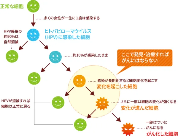 子宮頸がん発症のメカニズム