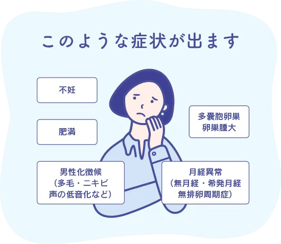 PCOSはこのような症状が出ます。不妊、肥満、男性化徴候（多毛・ニキビ・声の低音化など）、多嚢胞卵巣卵巣腫大、月経異常（無月経・希発月経無排卵周期症）