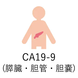 CA19-9