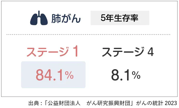 肺がん5年生存率。ステージ1で84.1%、ステージ4で8.1%