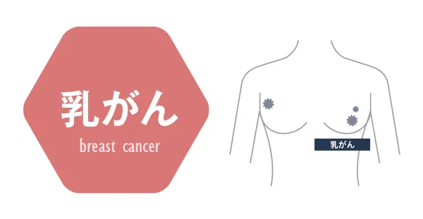 乳がん