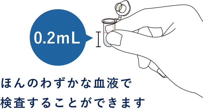 “がんリスク”チェックって？血液中に含まれる「腫瘍マーカー」と呼ばれる物質の量を測定し、がんのリスクを評価します。